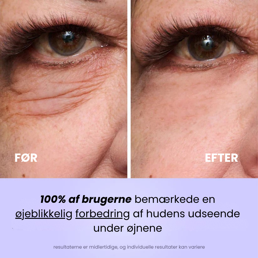 Ferdia™ Øjeblikkelig Øjenopstrammer